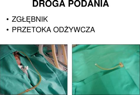 stmmi|stomia odżywcza.